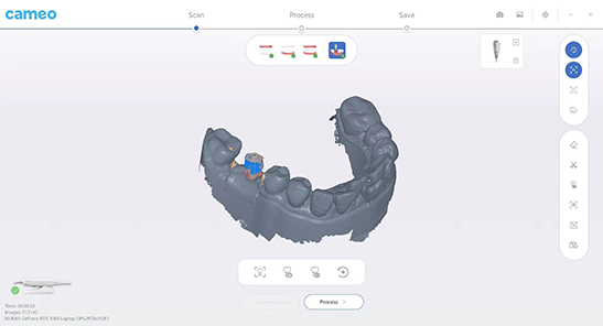Implant scan rod matching.png