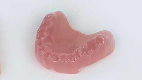 Digital denture manufactured with Aidite Denture Base Resin